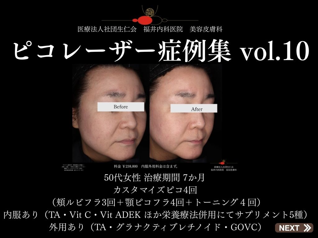 ピコレーザー症例_vol.10_001
