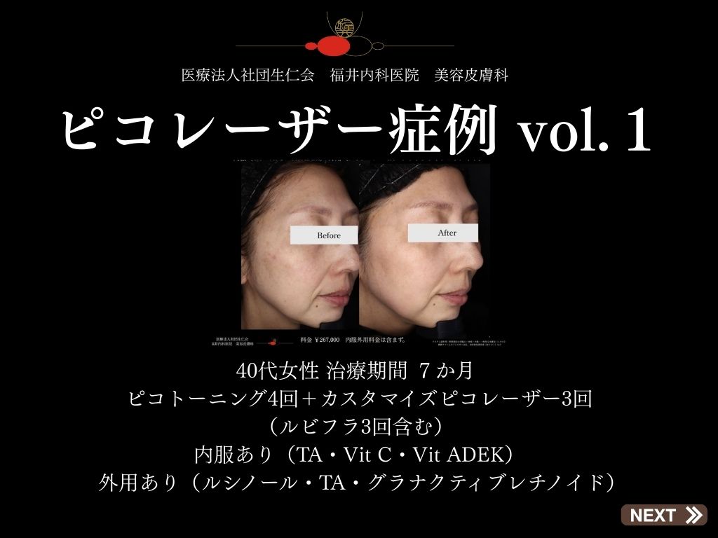 ピコレーザー症例_vol.1_001