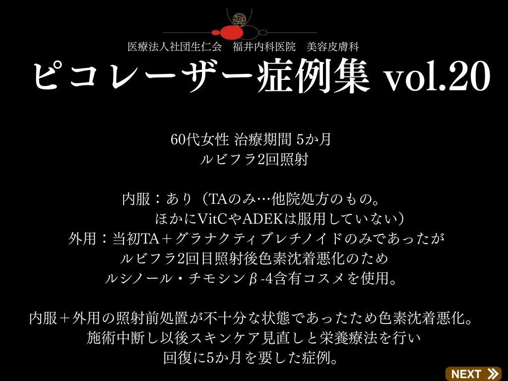 ピコレーザー症例_vol.20_001