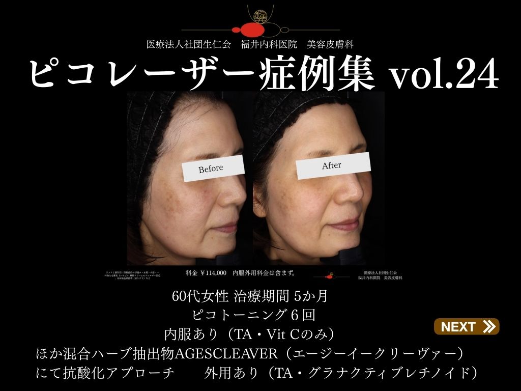 ピコレーザー症例_vol.24_001