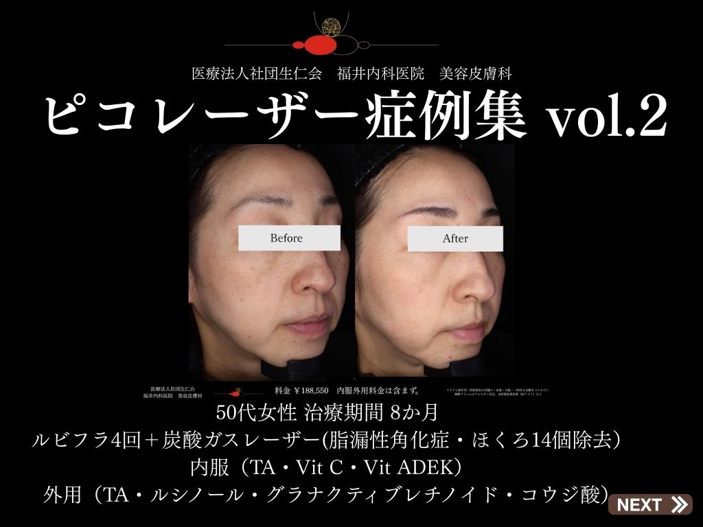 ピコレーザー症例_vol.2_001