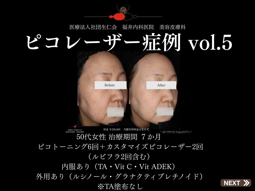 ピコレーザー症例_vol.5_001