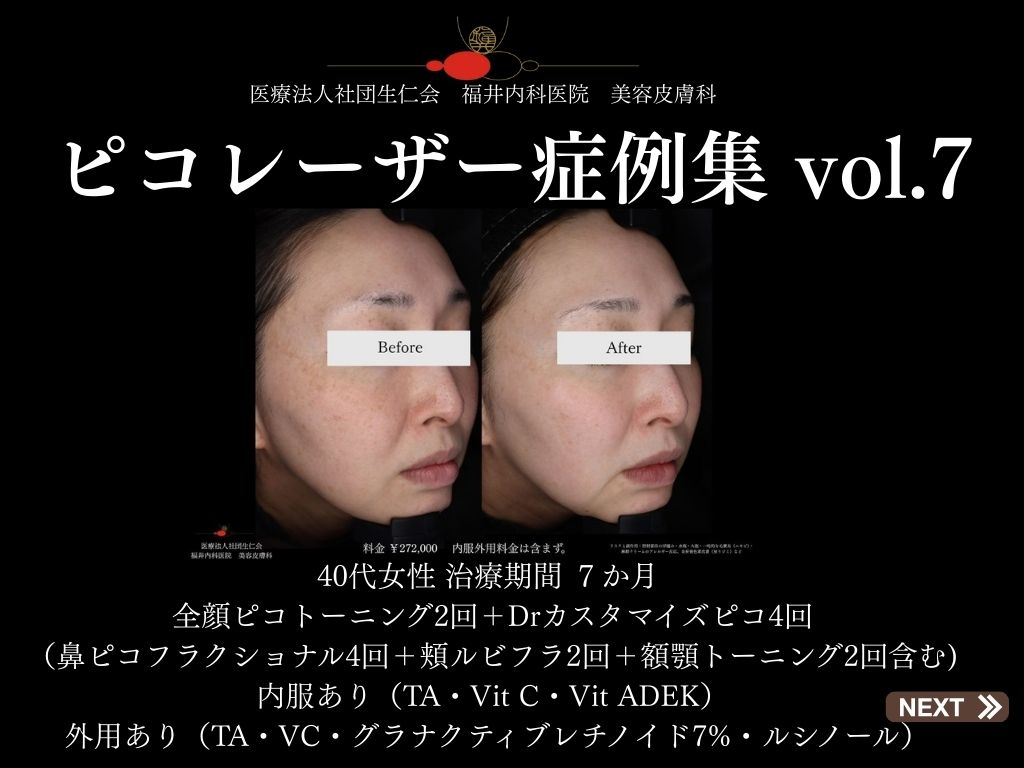 ピコレーザー症例_vol.7_001