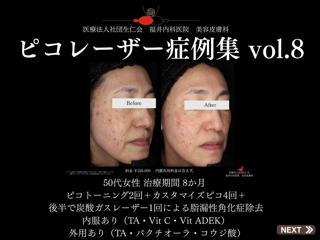 ピコレーザー症例_vol.8_001