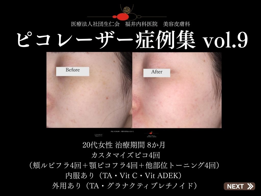 ピコレーザー症例_vol.9_001