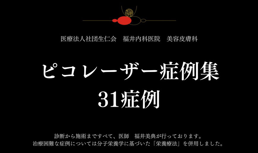 ピコレーザー症例集