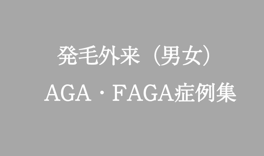 発毛外来（男女）AGA・FAGA症例集
