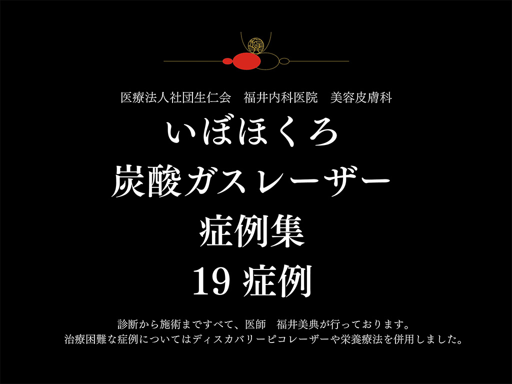 炭酸ガスレーザーの症例集
