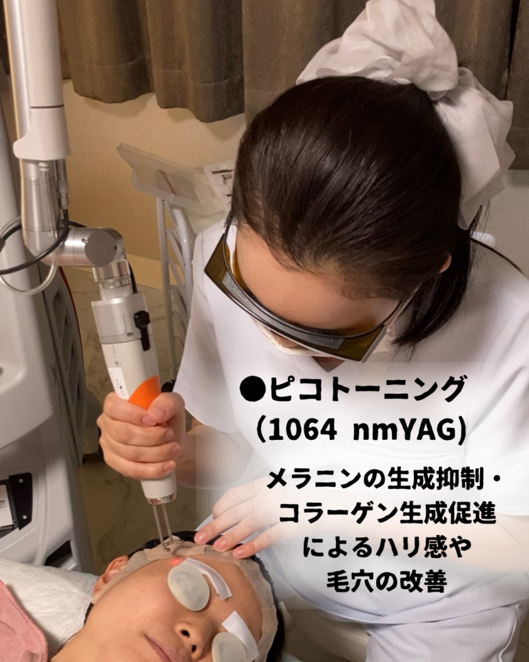 ピコトーニング