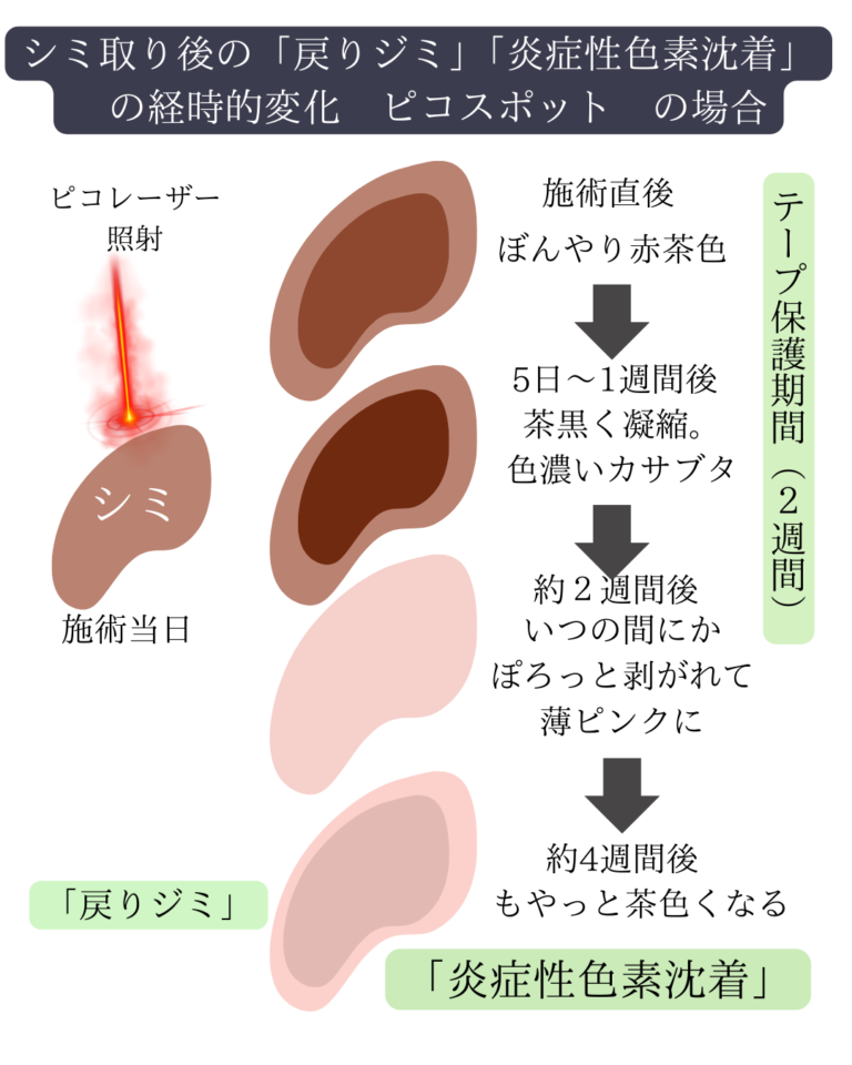 ピコスポット