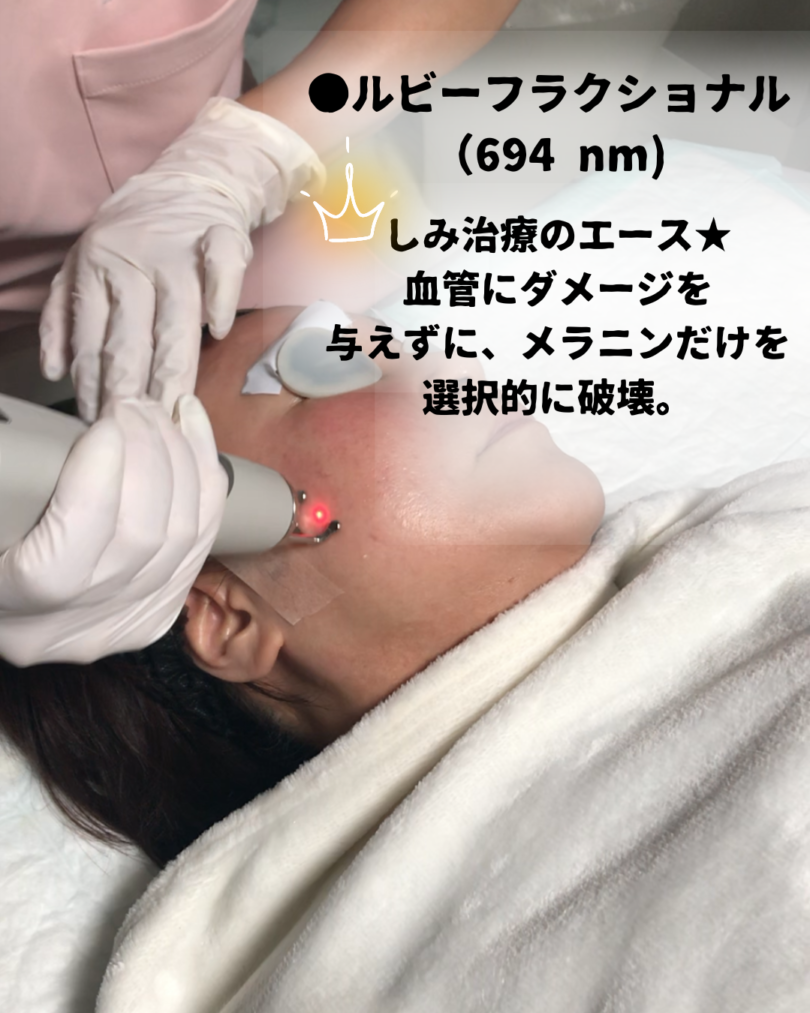 ディスカバリーピコレーザーの詳しい内容