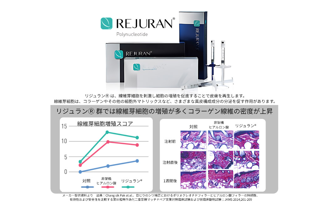 PN製剤（ポリヌクレオチド）リジュラン®注射とは？